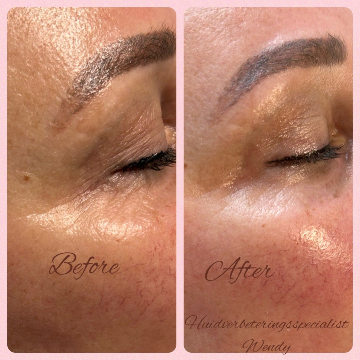 photo - Huidverbeteringsspecialist Wendy