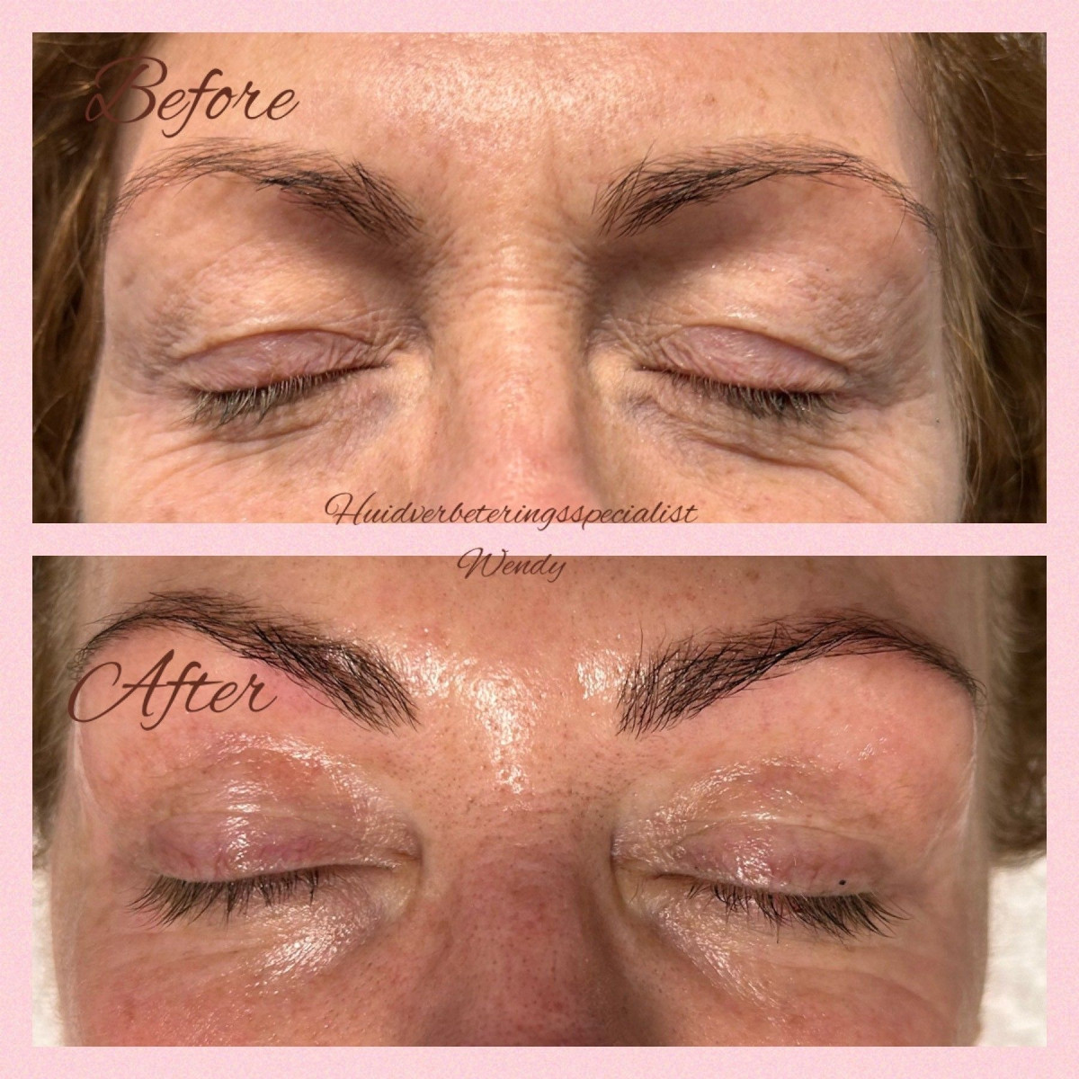photo - Huidverbeteringsspecialist Wendy