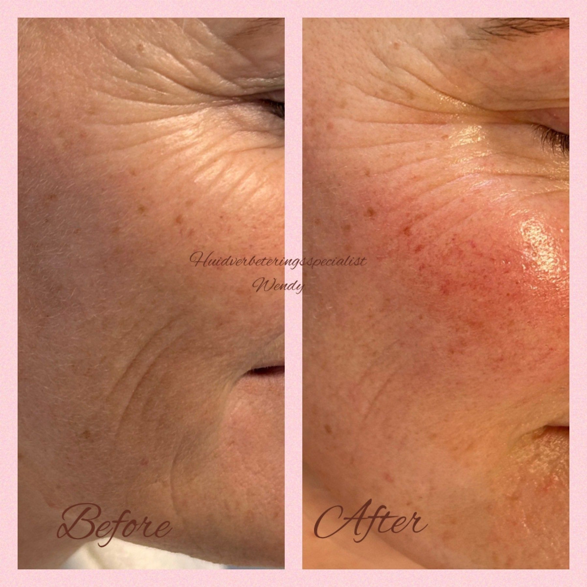 photo - Huidverbeteringsspecialist Wendy
