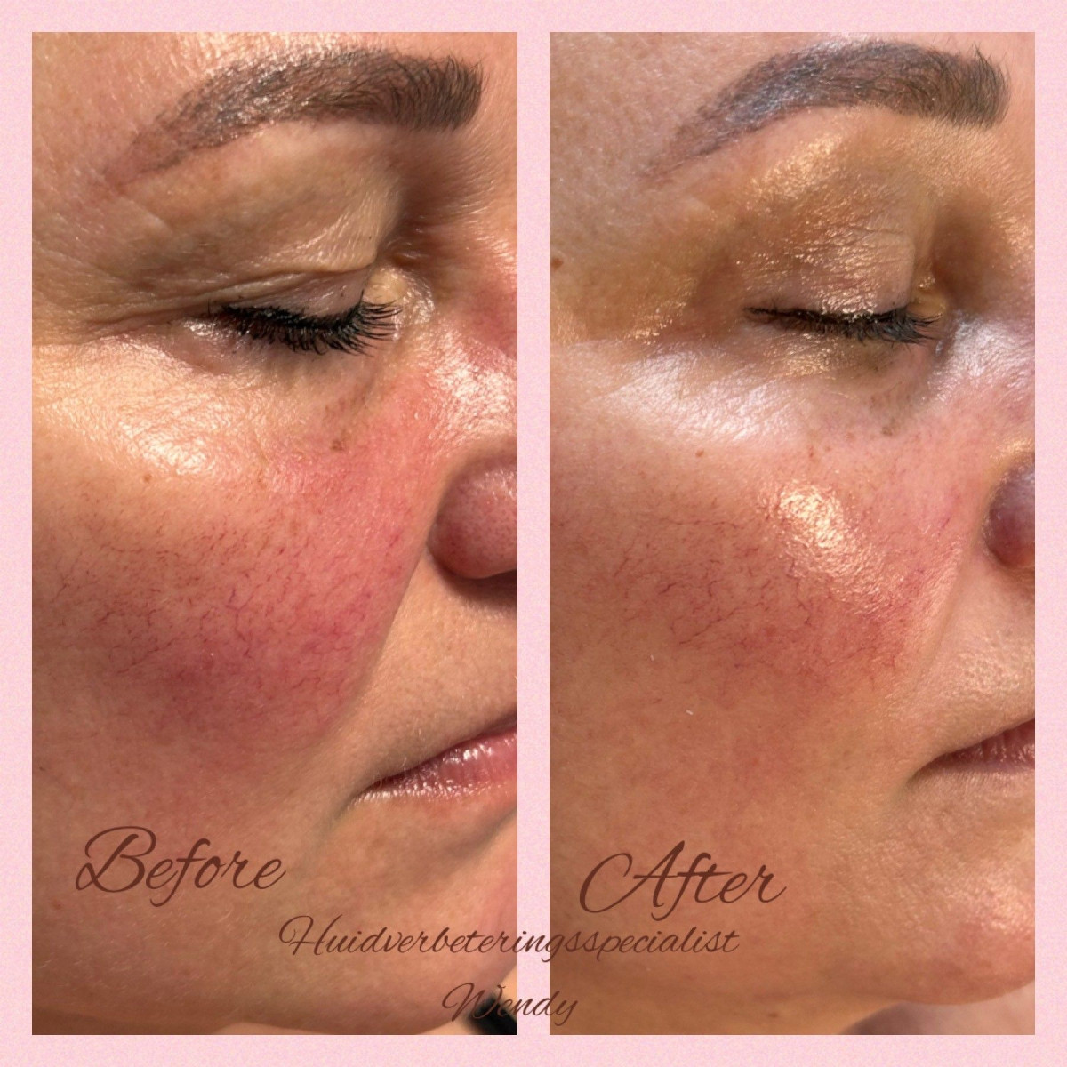 photo - Huidverbeteringsspecialist Wendy