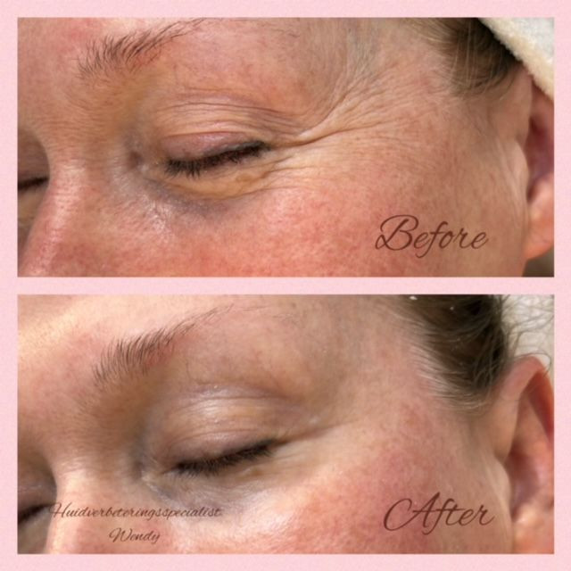 photo - Huidverbeteringsspecialist Wendy